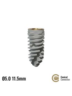 P5D Dental Implant ø5.0 x 11.5mm