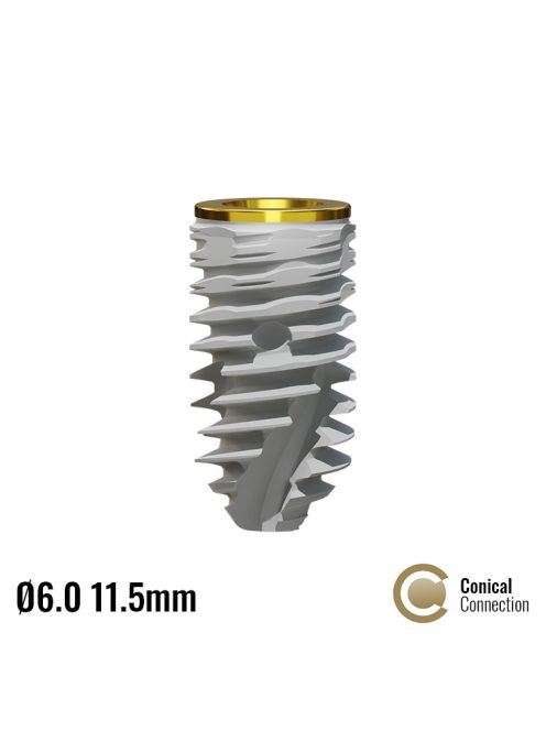 P5D Dental Implant ø6.0 x 10mm